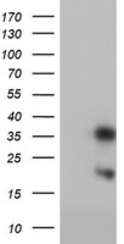 FXN Mouse anti-Human, Clone: OTI1C12, lyophilized, TrueMAB 100 &mu;g; Unconjugated:Antibodies,