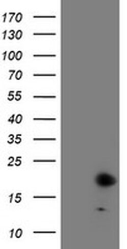 FXN Monoclonal Antibody (OTI1F2), TrueMAB , OriGene:Antibodies:Primary