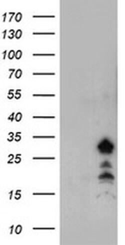 FXN Monoclonal Antibody (OTI3F3), TrueMAB , OriGene:Antibodies:Primary