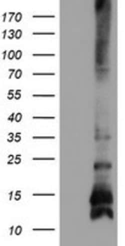 FXYD3 Mouse anti-Human, Clone: OTI1D1, lyophilized, TrueMAB 100 &mu;g;