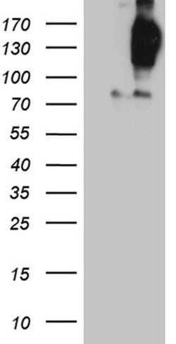 FYCO1 Monoclonal Antibody (OTI9D1), TrueMAB , OriGene 100 &mu;L; Unconjugated:Antibodies,