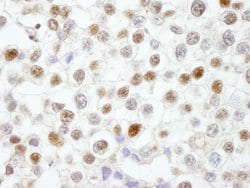 Fen1 Polyclonal Antibody, Bethyl Laboratories:Antibodies:Primary Antibodies