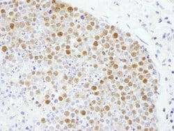 Fen1 Polyclonal Antibody, Bethyl Laboratories 100 &mu;L; Unconjugated:Antibodies,