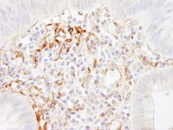 Filamin A Rabbit anti-Human, Polyclonal, Bethyl Laboratories 100 &mu;L;