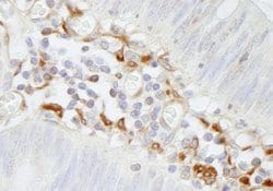 Filamin A Polyclonal Antibody, Bethyl Laboratories:Antibodies:Primary Antibodies