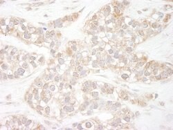 Flightless-1 Rabbit anti-Human, Polyclonal, Bethyl Laboratories 100 &mu;L;