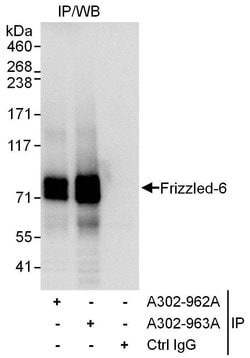 Frizzled-6 Rabbit anti-Human, Polyclonal, Bethyl Laboratories 10 &mu;L;