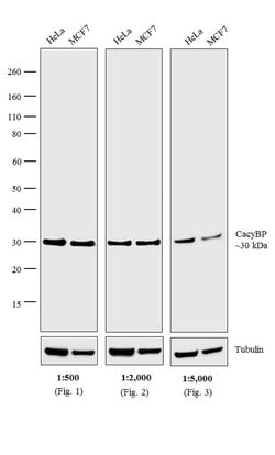 Invitrogen Goat anti-Rabbit IgG (H+L) Cross-Adsorbed Secondary Antibody,