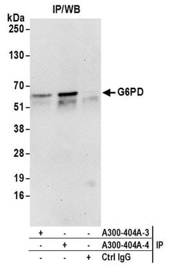 G6PD Rabbit anti-Human, Mouse, Polyclonal, Bethyl Laboratories 10 &mu;l;