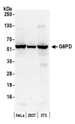 G6PD Rabbit anti-Human, Mouse, Polyclonal, Bethyl Laboratories 10 &mu;l;