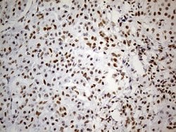 GABPB1 Mouse anti-Human, Clone: OTI7A7, lyophilized, TrueMAB 100 &mu;g;