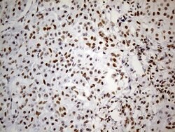 GABPB1 Mouse anti-Human, Clone: OTI7A7, TrueMAB , Origene 30 &mu;L | Buy Online | Origene Technologies | Fisher Scientific