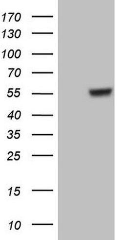 GABRA5 Monoclonal Antibody (OTI1G5), TrueMAB , OriGene 100 &mu;L; Unconjugated:Antibodies,