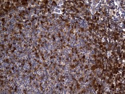 GALM Monoclonal Antibody (OTI4F4), TrueMAB , OriGene 100 &mu;L; Unconjugated:Anticuerpos