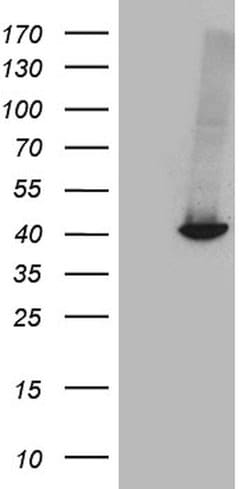 GALM Monoclonal Antibody (OTI7B7), TrueMAB , OriGene:Antibodies:Primary