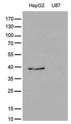 GALM Monoclonal Antibody (OTI7B7), TrueMAB , OriGene 30 &mu;L; Unconjugated:Antibodies,