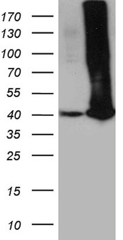 GALM Monoclonal Antibody (OTI10B3), TrueMAB , OriGene 100 &mu;L; Unconjugated:Antibodies,