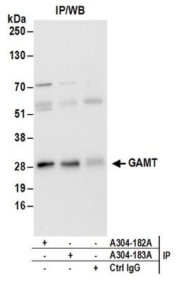GAMT Rabbit anti-Human, Polyclonal, Bethyl Laboratories 100 &mu;l; Unlabeled:Antibodies,