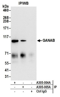 GANAB/Glucosidase II Subunit alpha Rabbit anti-Human, Mouse, Polyclonal,