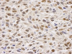 GAPDH Polyclonal Antibody, Bethyl Laboratories:Antibodies:Primary Antibodies