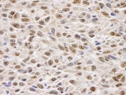 GAPDH Polyclonal Antibody, Bethyl Laboratories:Antibodies:Primary Antibodies