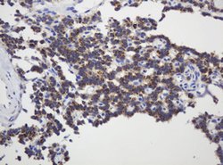 GAPDHS Mouse anti-Human, Clone: OTI1F6, lyophilized, TrueMAB 100 &mu;g;