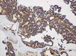 GAPDHS Mouse anti-Human, Clone: OTI1F6, lyophilized, TrueMAB 100 &mu;g;