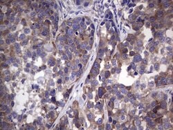 GARS Monoclonal Antibody (OTI4H8), TrueMAB , OriGene 100 &mu;L; Unconjugated:Antibodies,