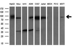 GARS Monoclonal Antibody (OTI4H8), TrueMAB , OriGene 100 &mu;L; Unconjugated:Antibodies,