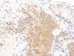 GART Rabbit anti-Human, Mouse, Polyclonal, Bethyl Laboratories 100 &mu;l;