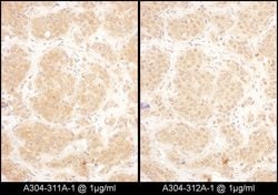 GART Rabbit anti-Human, Mouse, Polyclonal, Bethyl Laboratories 100 &mu;L;