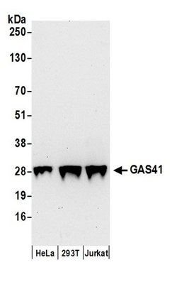 GAS41 Polyclonal Antibody, Bethyl Laboratories 20 &mu;L | Buy Online | Bethyl Laboratories, Inc | Fisher Scientific