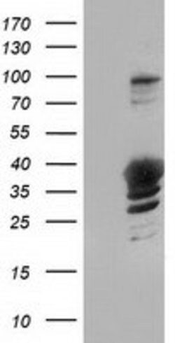 GAS7 Mouse anti-Human, Clone: OTI9H6, lyophilized, TrueMAB 100 &mu;g; Unconjugated:Antibodies,