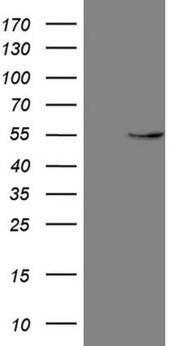 GAS8 Monoclonal Antibody (OTI10G2), TrueMAB , OriGene 100 &mu;L; Unconjugated:Antibodies,