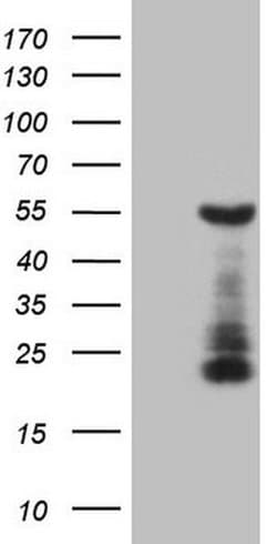 GATA3 Monoclonal Antibody (OTI1A5), TrueMAB , OriGene 30 &mu;L; Unconjugated:Antibodies,