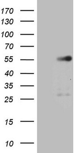 GATA3 Monoclonal Antibody (OTI8E11), TrueMAB , OriGene 100 &mu;L | Buy Online | OriGene | Fisher Scientific