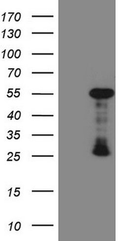 GATA3 Mouse anti-Human, Clone: OTI10G7, lyophilized, TrueMAB 100 &mu;g;