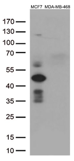 GATA3 Mouse anti-Human, Clone: OTI10G7, lyophilized, TrueMAB 100 &mu;g;