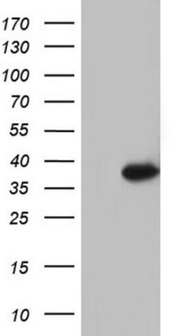 GATAD1 Mouse anti-Human, Clone: OTI1H1, lyophilized, TrueMAB 100 &mu;g;