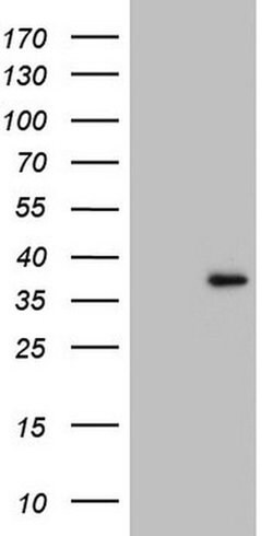 GATAD1 Monoclonal Antibody (OTI3B12), TrueMAB , OriGene 100 &mu;L; Unconjugated:Antibodies,