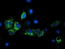 GATM Mouse anti-Human, Clone: OTI1C9, liquid, TrueMAB 100 &mu;L; Unconjugated:Antibodies,