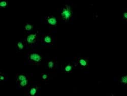 GATM Mouse anti-Human, Clone: OTI1E3, lyophilized, TrueMAB 100 &mu;g; Unconjugated:Antibodies,