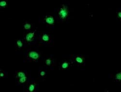 GATM Mouse anti-Human, Clone: OTI1E3, liquid, TrueMAB 100 &mu;L; Unconjugated:Antibodies,