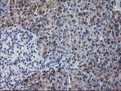 GATM Mouse anti-Human, Clone: OTI1C9, lyophilized, TrueMAB 100 &mu;g; Unconjugated:Antibodies,
