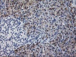 GATM Mouse anti-Human, Clone: OTI1C9, liquid, TrueMAB 100 &mu;L; Unconjugated:Antibodies,