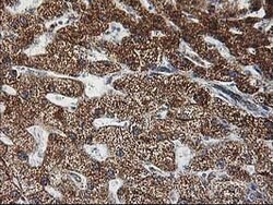 GATM Mouse anti-Human, Clone: OTI1C9, lyophilized, TrueMAB 100 &mu;g; Unconjugated:Antibodies,