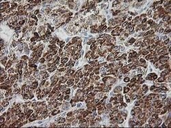 GATM Mouse anti-Human, Clone: OTI1C9, liquid, TrueMAB 100 &mu;L; Unconjugated:Antibodies,