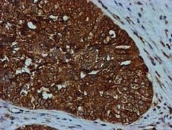 GATM Mouse anti-Human, Clone: OTI1E3, liquid, TrueMAB 100 &mu;L; Unconjugated:Antibodies,
