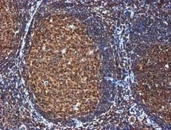GATM Mouse anti-Human, Clone: OTI1E3, liquid, TrueMAB 100 &mu;L; Unconjugated:Antibodies,
