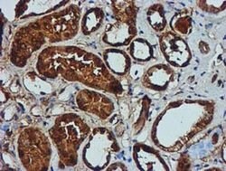 GATM Mouse anti-Human, Clone: OTI1E3, liquid, TrueMAB 100 &mu;L; Unconjugated:Antibodies,